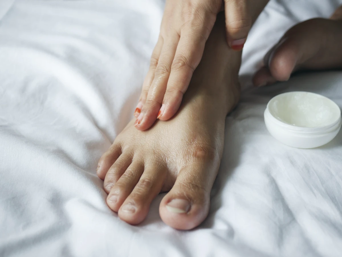 A hand applying cream to the top of a bare foot resting on white bedding