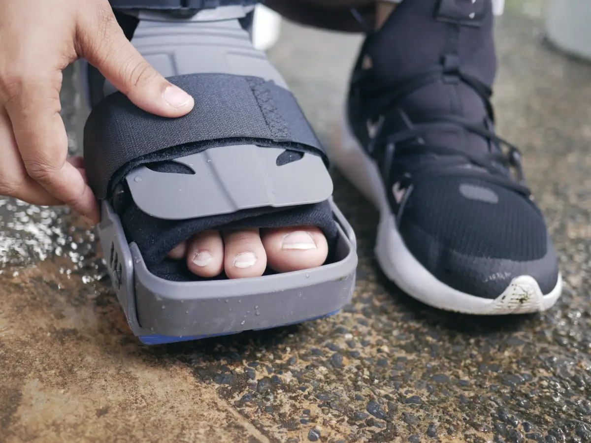 A foot supported in an orthopaedic ankle brace during recovery