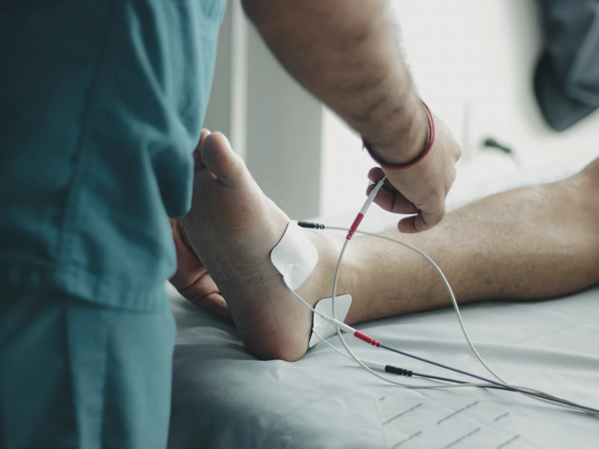 A clinician attaching nerve testing electrodes to a patient's foot and ankle in clinic