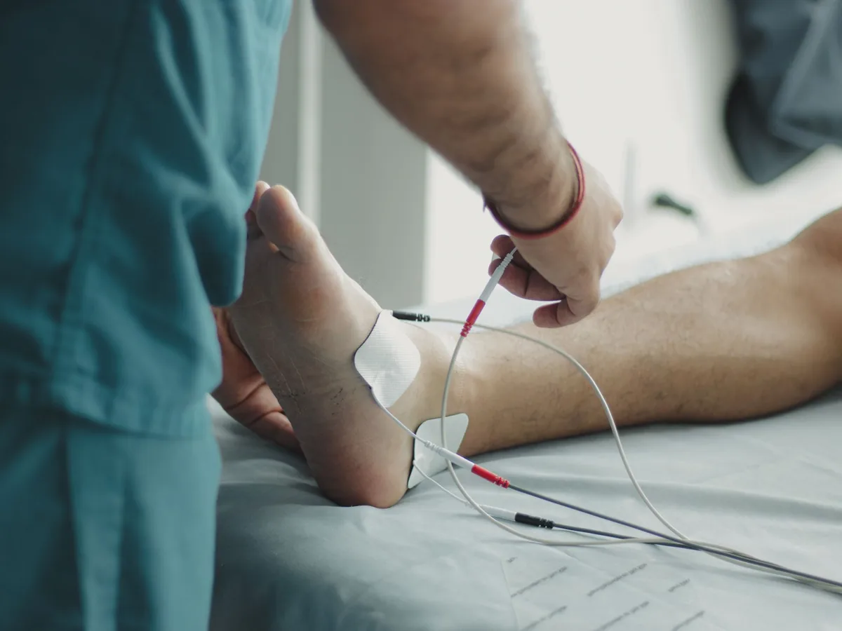A clinician holding a nerve stimulator against a patient’s ankle, with recording electrodes taped to the foot